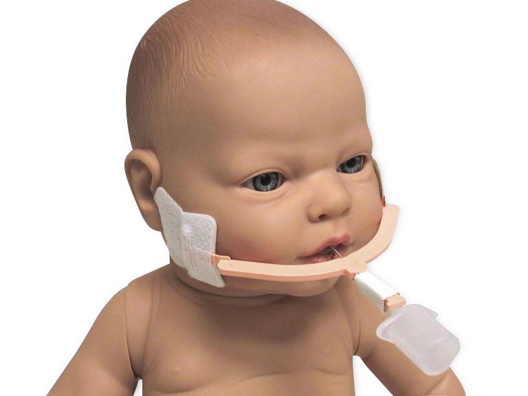 Neotech NeoBar N715H Macro, sujetador pediátrico para tubo endotraqueal