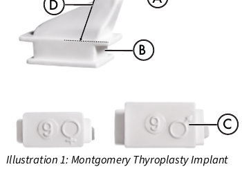 Boston Medical Montgomery Thyroplasty Implant masculino