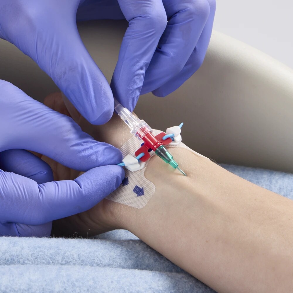 Colocación del fijador Alpha FlexGRIP sobre las alas del catéter
