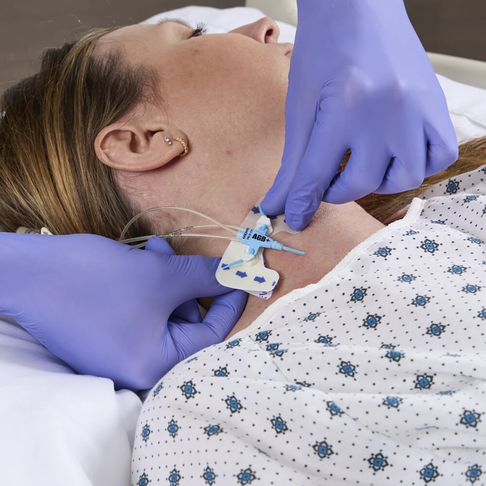 Fijador Alpha FlexGRIP sujetando un catéter venoso central en el cuello