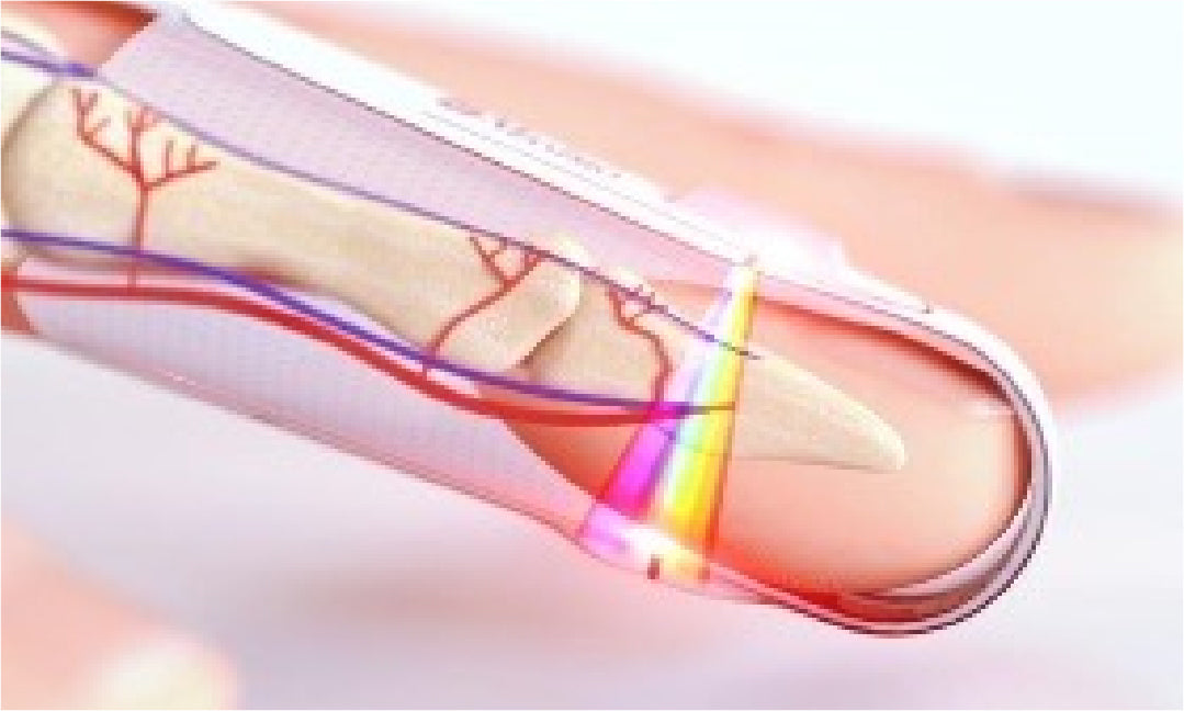 Ilustración Masimo de tecnología óptica rainbow; venta de licenciaORi3950, sin sensor o monitor incluidos