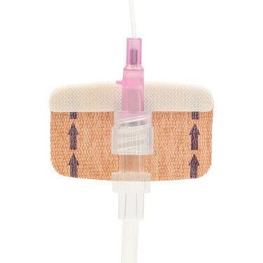 Fijador FlexGRIP Neo. PIVC neonatal sujetando un catéter intravenoso