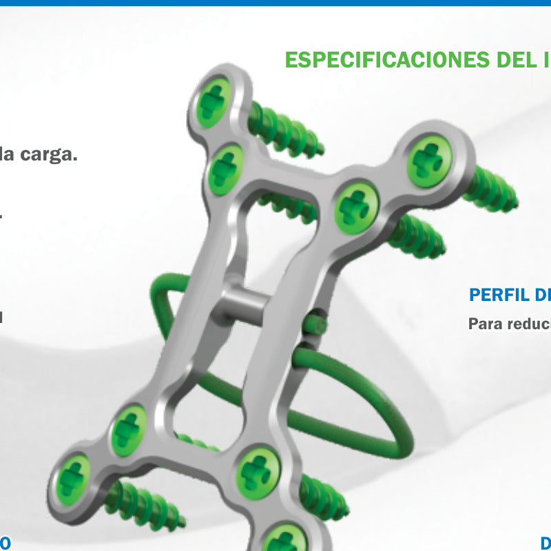 Sistema Tritium con tornillos esternales de titanio de 2.7 mm